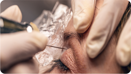 Fibroblast-Treatment